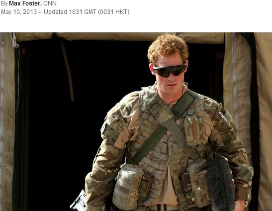 Welcome Prince Harry to do Hair Transplantation