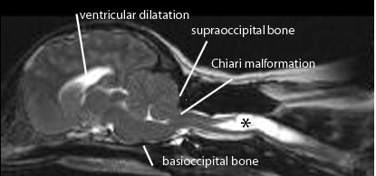 syringomyelia2