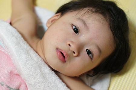 Emma(1Y1M)第一次生病 Emma(1Y1M)第一次生病