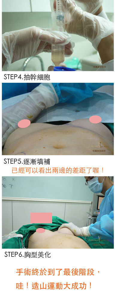 手術過程2.jpg 手術過程2.jpg