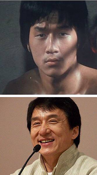 雙眼皮手術 雙眼皮手術