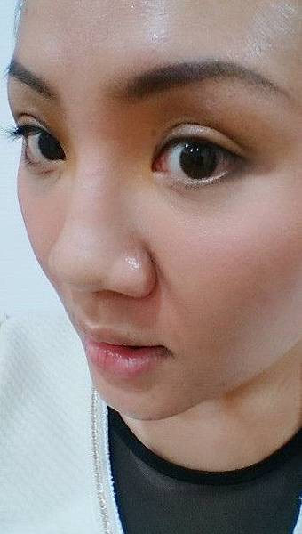雙眼皮