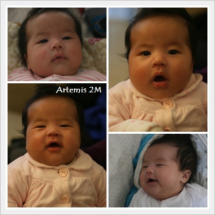 Artemis 2M-2.jpg Artemis 2M-2.jpg
