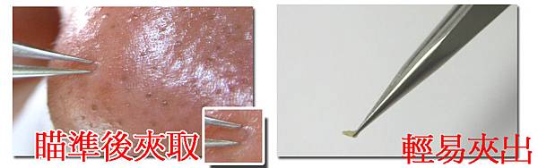 osmo粉刺夾 osmo粉刺夾