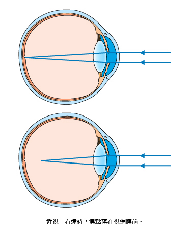 29 近視.jpg 29 近視.jpg