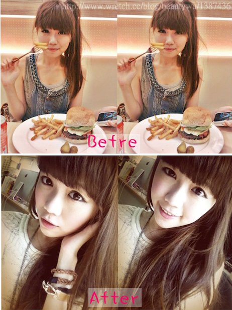 愛心臉微晶瓷玻尿酸美麗晶華12