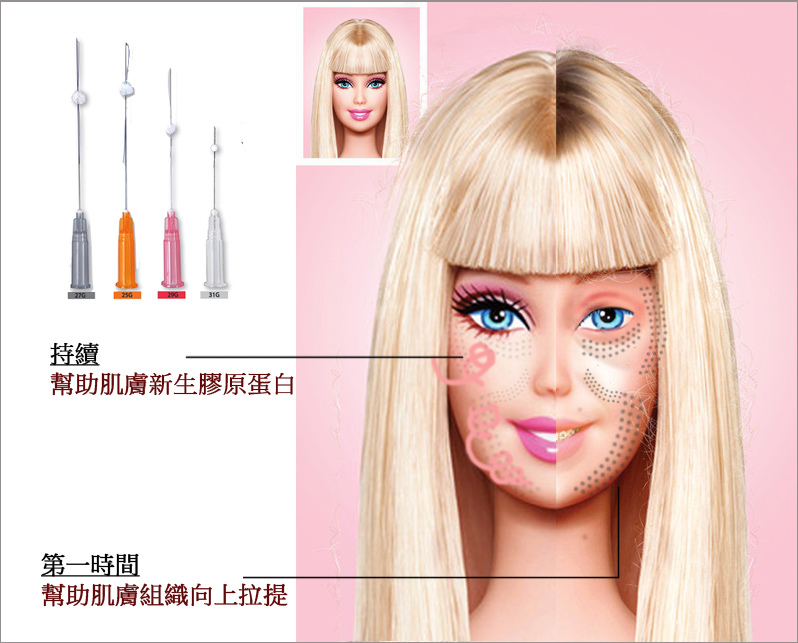 微晶瓷玻尿酸膠原蛋白4D羽毛線拉提維納斯曲線電波3D立體電波拉皮3D立體電波拉皮00012