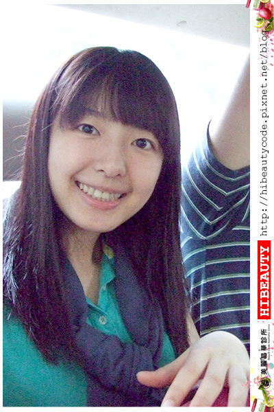 4D羽毛線拉皮 埋線拉皮 價格 推薦 埋線拉皮 推薦 埋線拉皮 費用 美麗晶華 埋線拉提 蘋果肌 嬰兒肥01.jpg 4D羽毛線拉皮 埋線拉皮 價格 推薦 埋線拉皮 推薦 埋線拉皮 費用 美麗晶華 埋線拉提 蘋果肌 嬰兒肥01.jpg