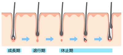 hair_3 hair_3