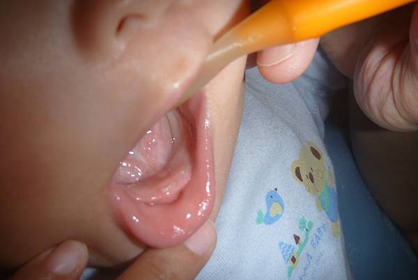 01.P1450509-首次小白點