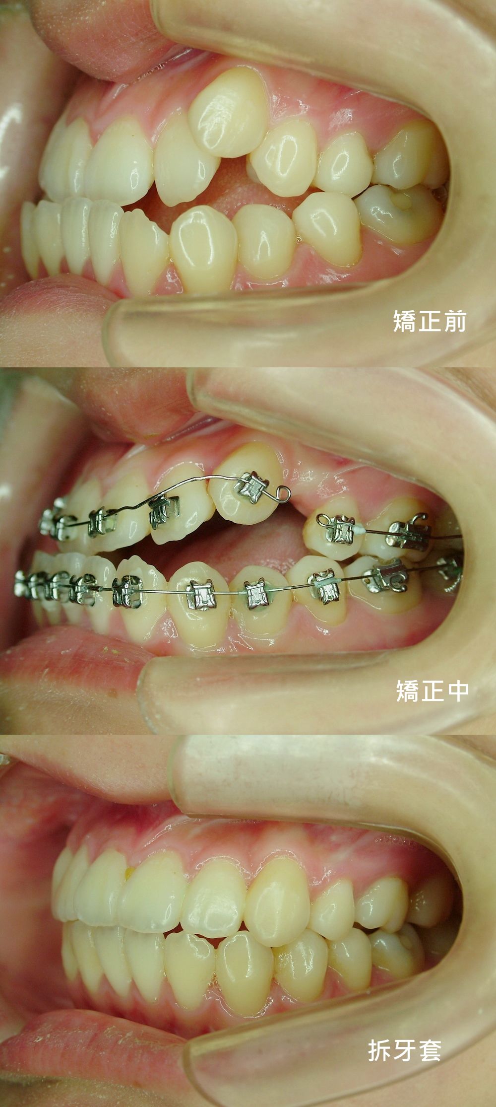 下一張(熱鍵:c)