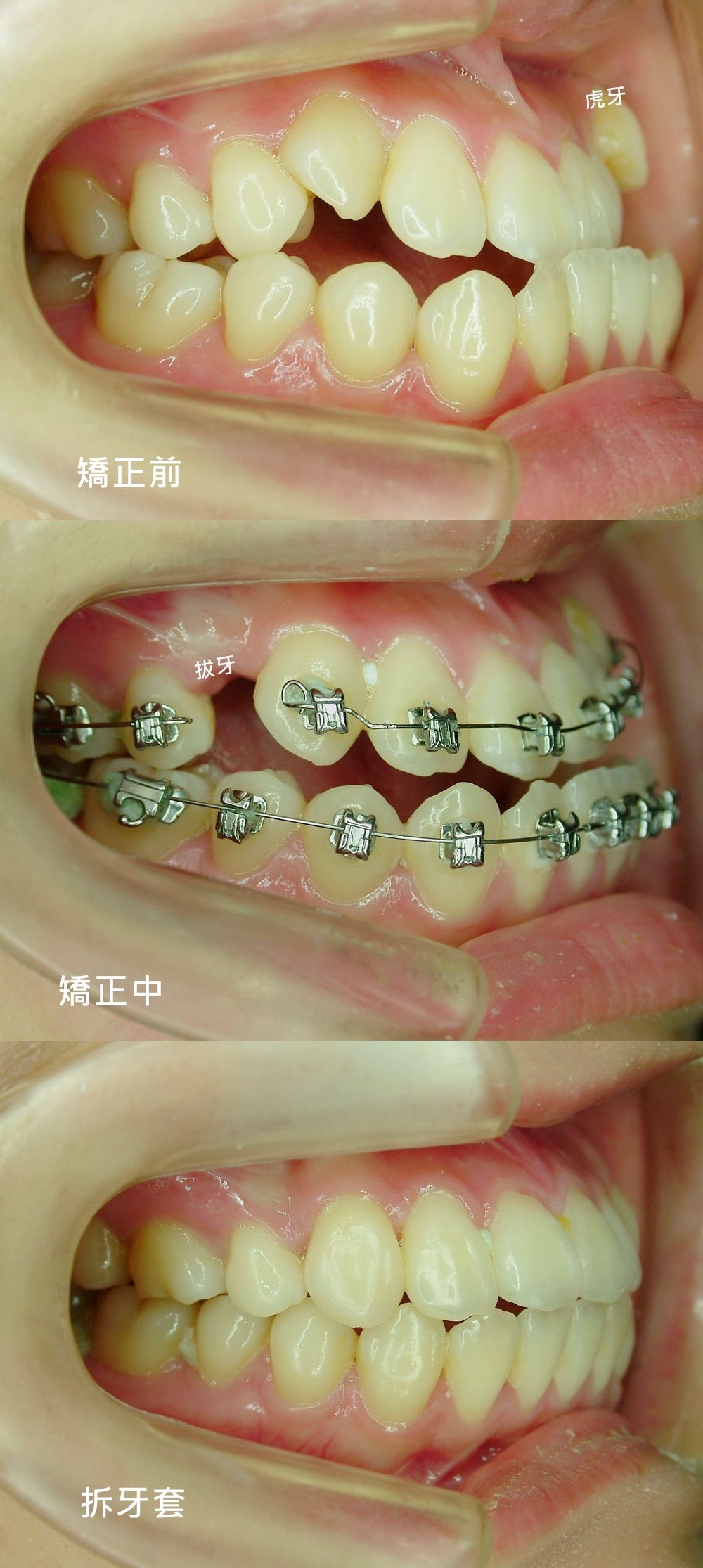 下一張(熱鍵:c)