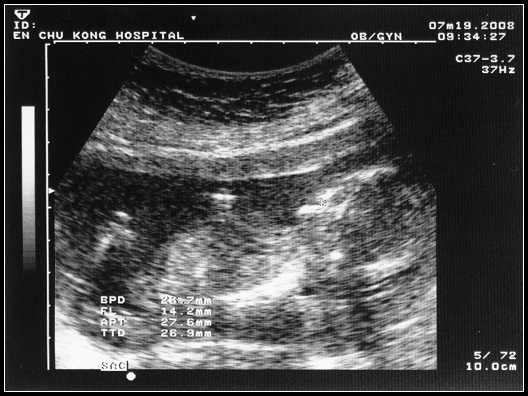 20080721 小球的小雞雞呢? 20080721 小球的小雞雞呢?