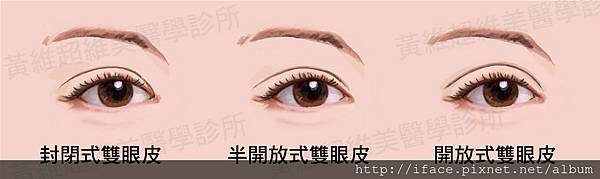 雙眼皮文章08 雙眼皮文章08