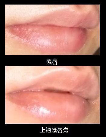 唇 唇