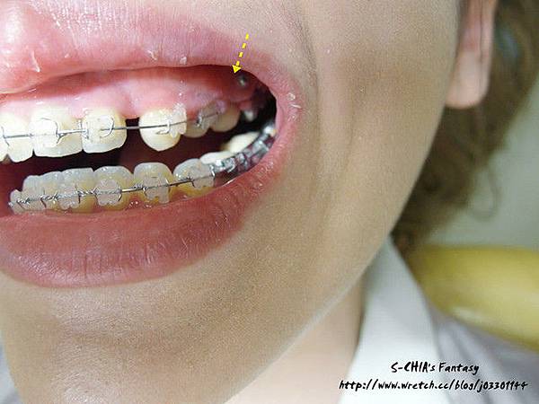 1384541778-1116337876