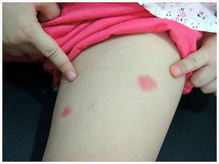 別蚊我草本修護凝膠6