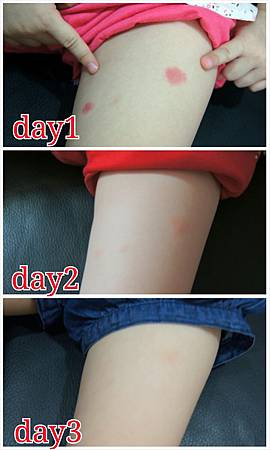 別蚊我草本修護凝膠10 別蚊我草本修護凝膠10