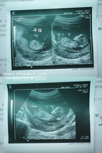 20120721-1