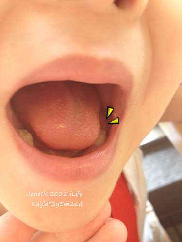 1010828 [2y5m26d]