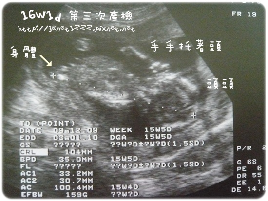 98.9.12 第三次產檢 (3).JPG