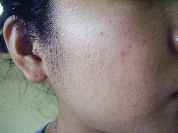 0815.jpg 0815.jpg