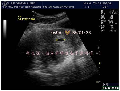 美国供卵代生代怀的整个过程是现场直播的!供卵试管婴儿助孕