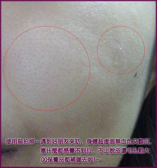 LANCOME肌+微整-17.jpg LANCOME肌+微整-17.jpg