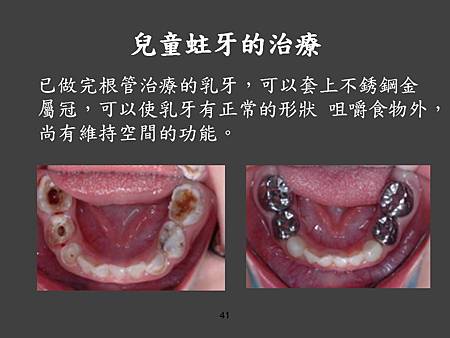 投影片41.JPG