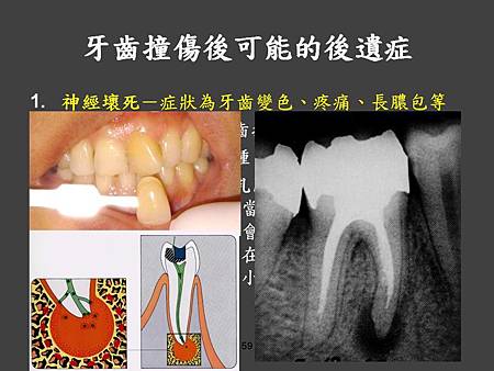 投影片59.JPG