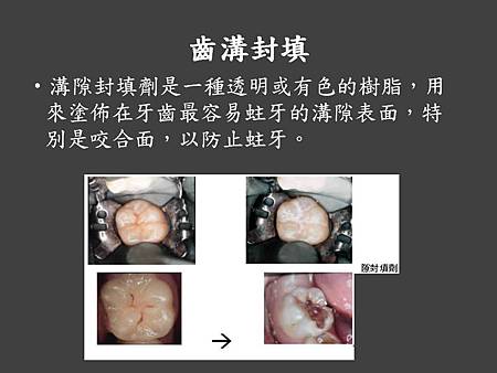 投影片90.JPG