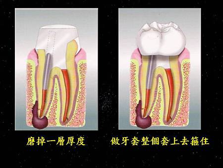 投影片4.JPG