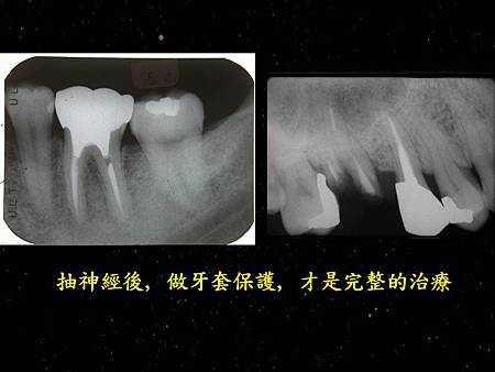 投影片5.JPG