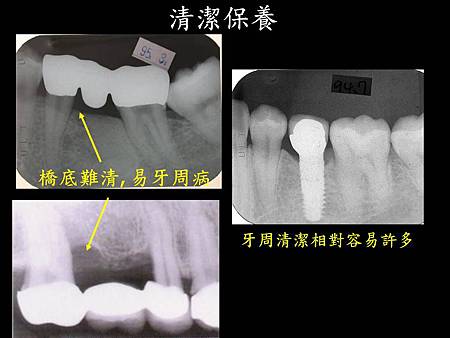 投影片5.JPG