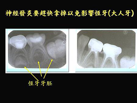 投影片5.JPG