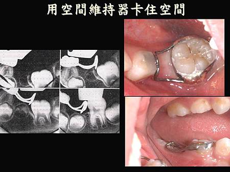 投影片4.JPG