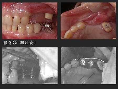 投影片9.JPG