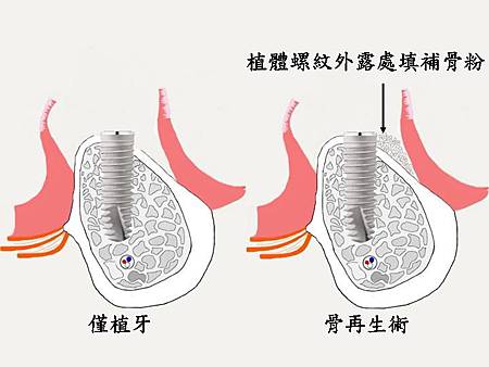 投影片10.JPG