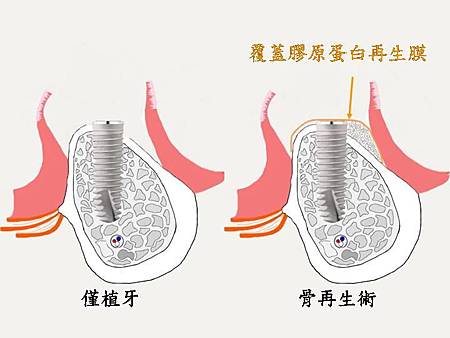 投影片11.JPG