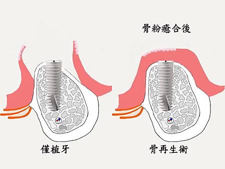 投影片13.JPG