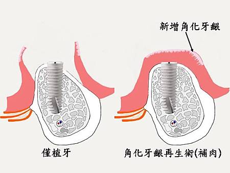 投影片14.JPG