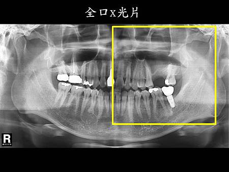 投影片3.JPG