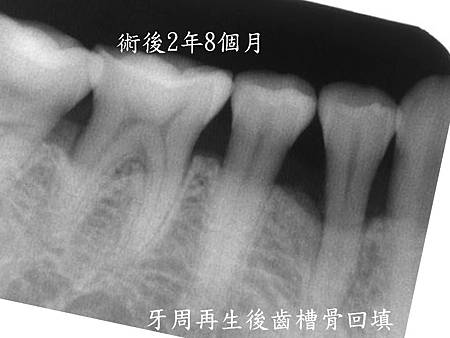 投影片3.JPG