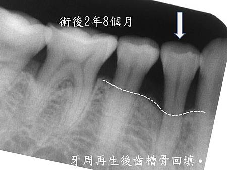 投影片4.JPG