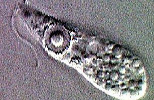 巴基斯坦出現專吃大腦寄生蟲(brain-eating amoeba) - 專吃大腦寄生蟲 巴基斯坦出現專吃大腦寄生蟲(brain-eating amoeba) -
專吃大腦寄生蟲