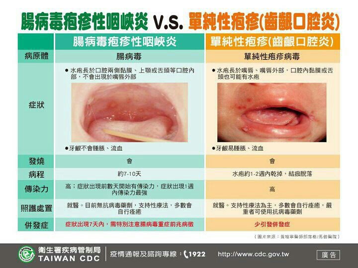 The truth about HSV-1 and HSV-2 - Herpes & Cold Sores (HC ...