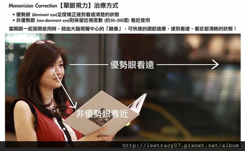 老花眼雷射~什麼是單眼視力矯正
