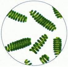 【松果体的钙化排除与解毒】
