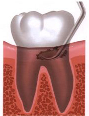teeth_2.jpg teeth_2.jpg