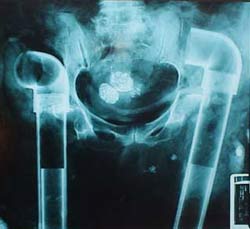 2006_02_pvcskeleton.jpg